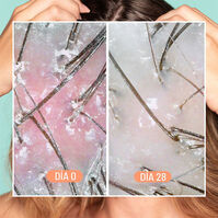 Dandruff & Scalp Exfoliating Treatment  50ml-214487 Dandruff & Scalp Exfoliating Treatment  50ml-214487 4